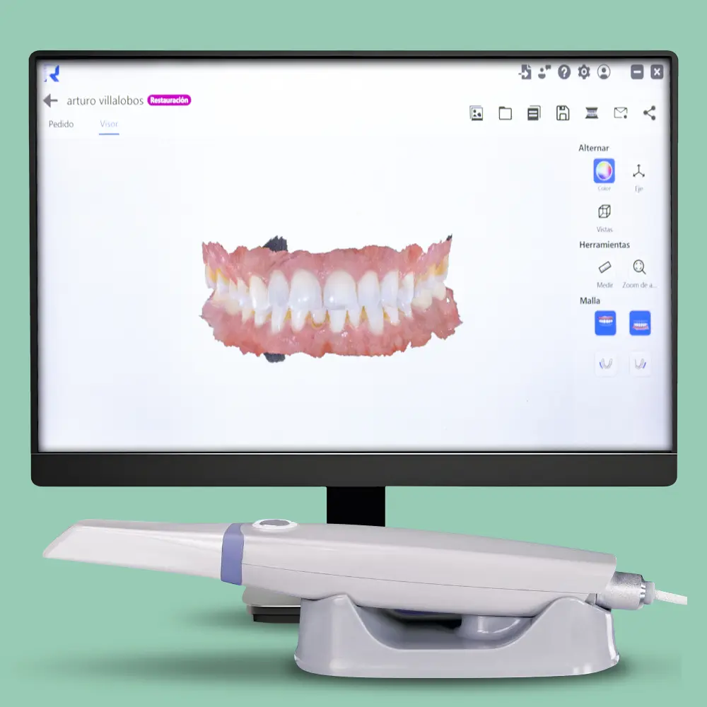 sonrisa limpia y radiante en mym dental
